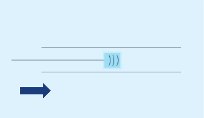 Schematic showing the device inserted into the urethral channel